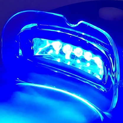 Remedy Health Professional Teeth Whitening Kit – Complete LED Teeth Whitening System